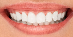 SEO for Dental: from 1022 Visits to 6951